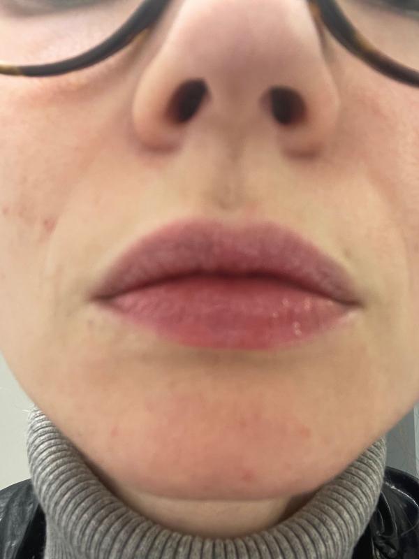 Review Thumbnail Image 1 1141165139