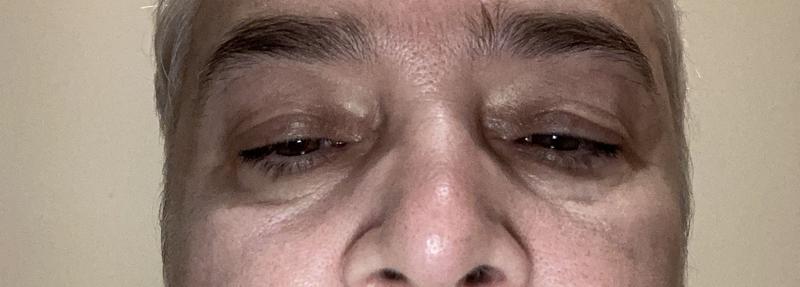 Customer photo for "Eye mask"