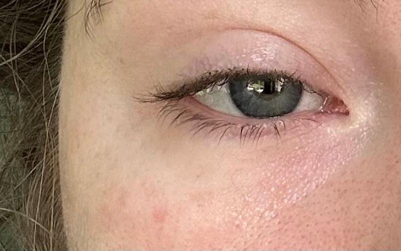 Customer photo for "Real Life Photoshop For Your Eye Area"