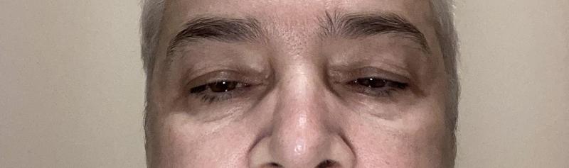 Customer photo for "Eye mask"