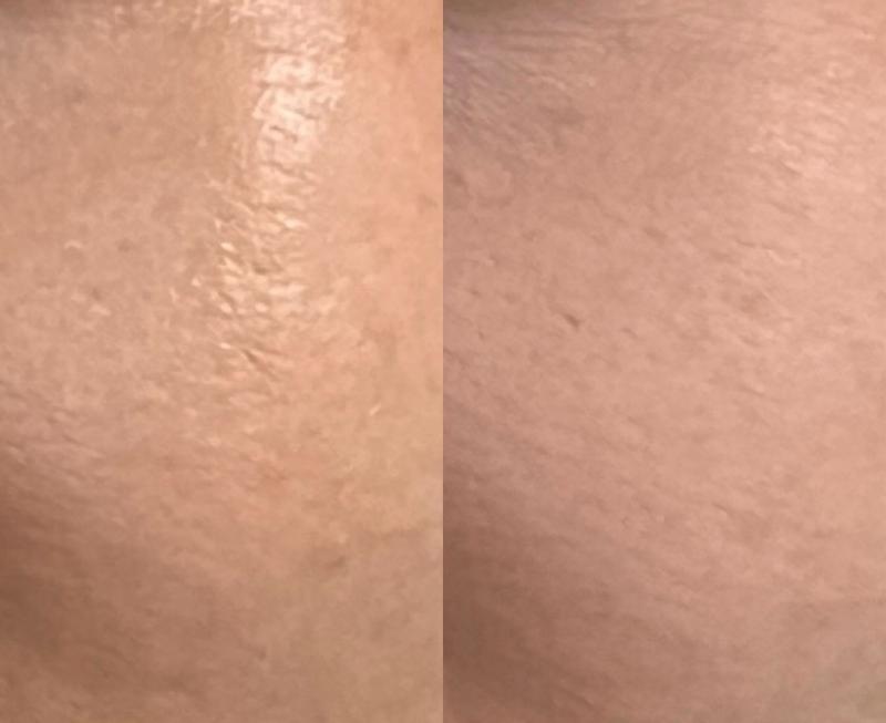 Review Thumbnail Image 0 299860940