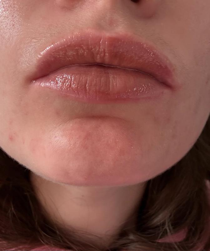 Review Thumbnail Image 0 300050170