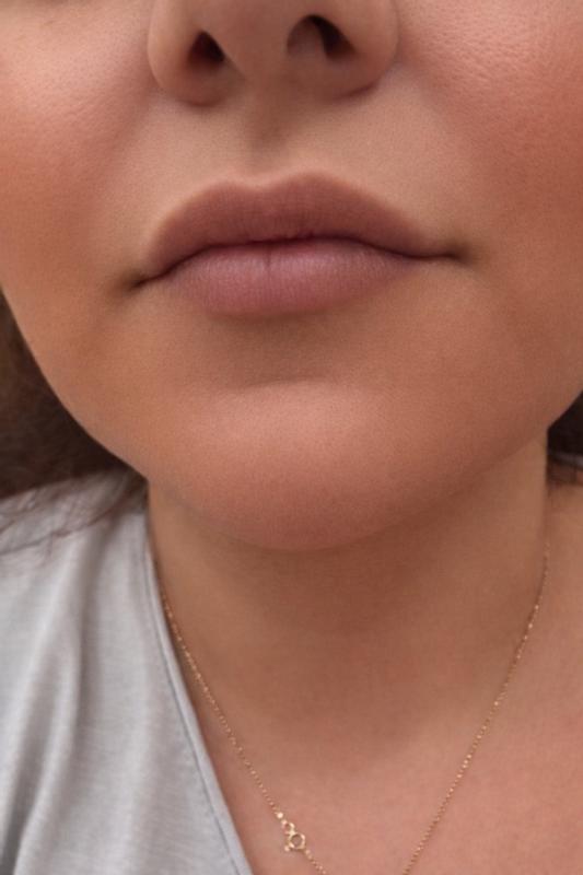 Review Thumbnail Image 1 299946647