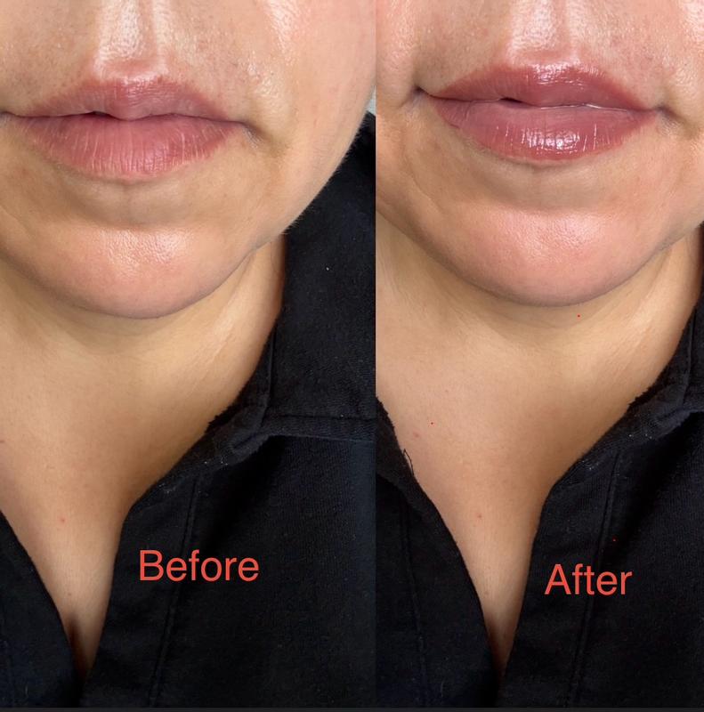 Review Thumbnail Image 1 300165096