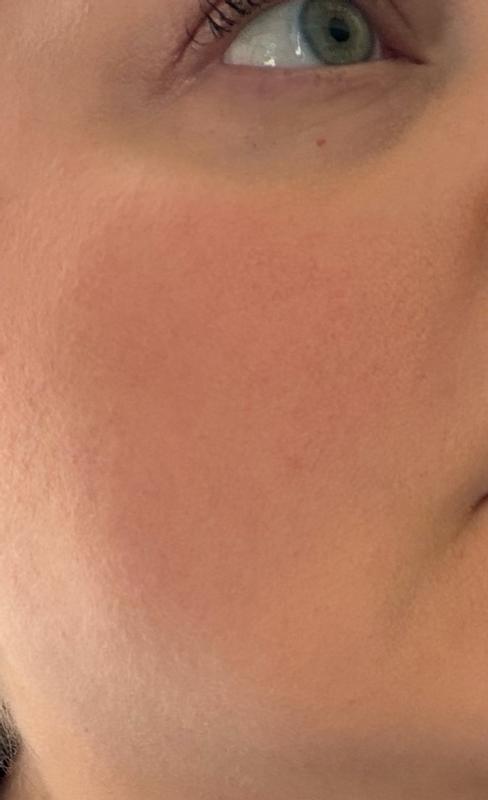 Review Thumbnail Image 0 299754975