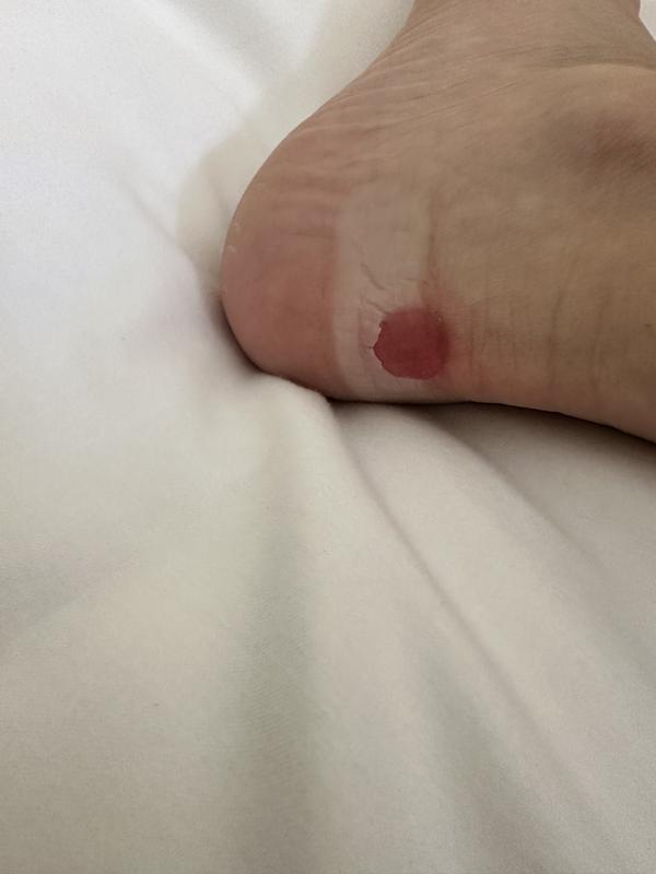 Photo submitted with review of product