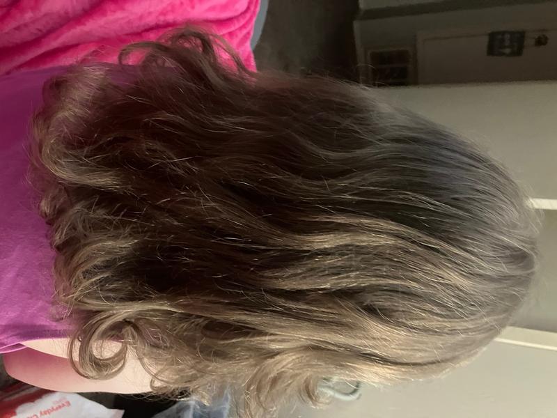 Top 115 + Low vitamin d hair loss reddit polarrunningexpeditions