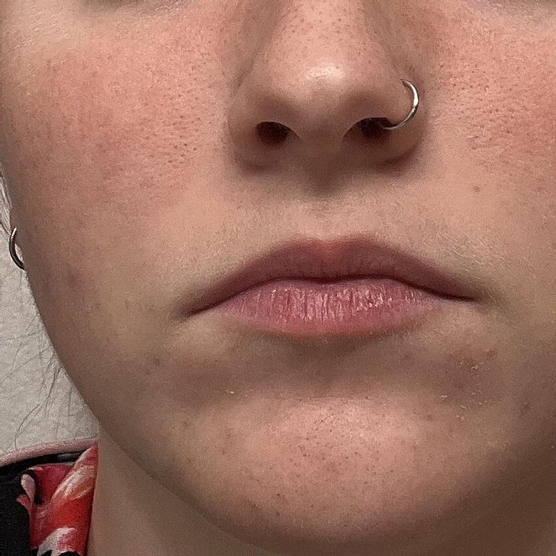 Customer carousel item 7.