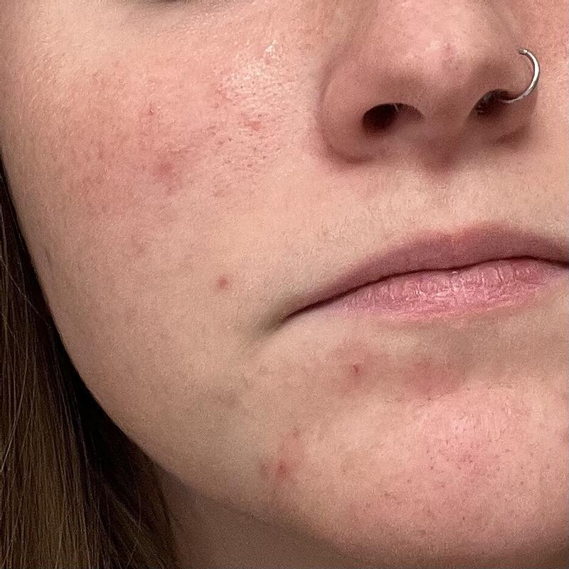 Customer carousel item 3.