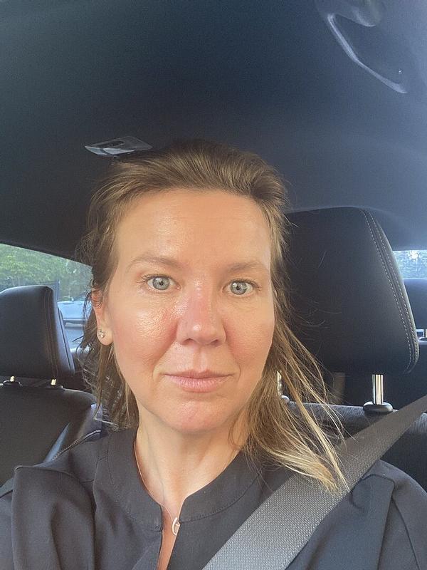 Customer photo for "I love this Alpha-Arbutin serum!"