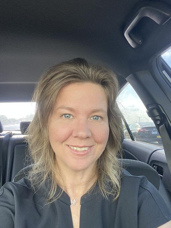 Customer photo for "I love this Alpha-Arbutin serum!"