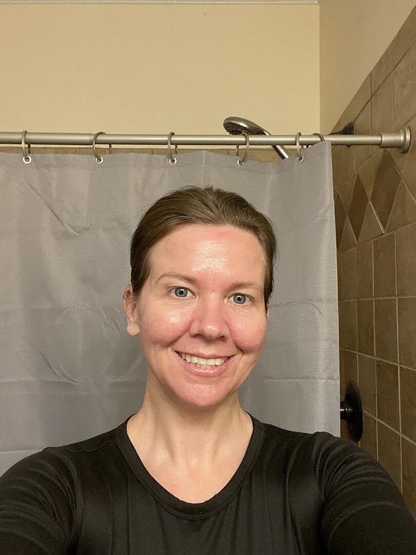 Customer photo for "I love this Alpha-Arbutin serum!"