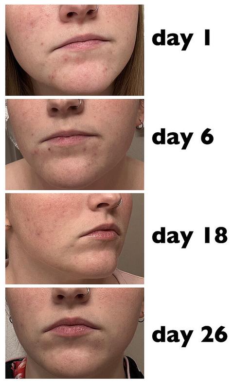 Customer carousel item 6.