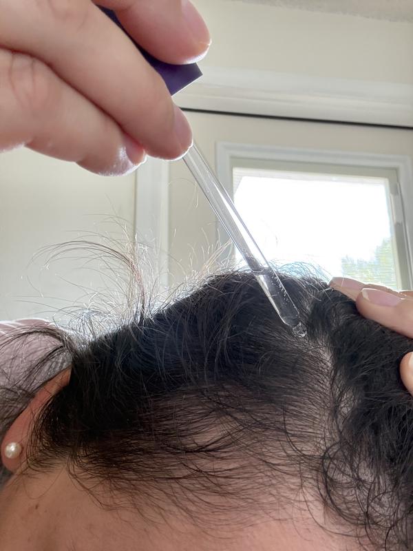 Customer photo for "My new addition into my hair routine"