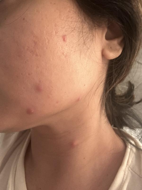 Breakouts