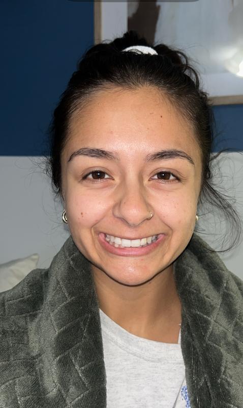 After 1 year of consistent use