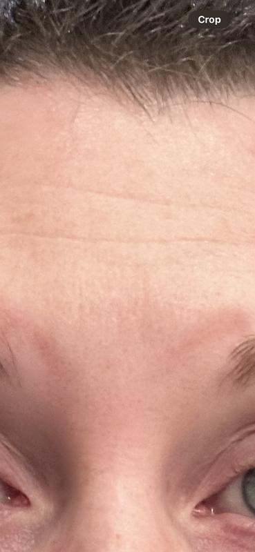 Before using compared to 7 months later