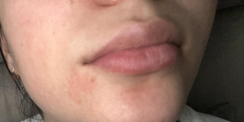 Customer carousel item 2.