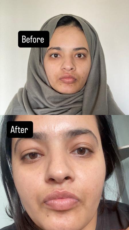Customer photo for "Ammmmmmazing face serum"
