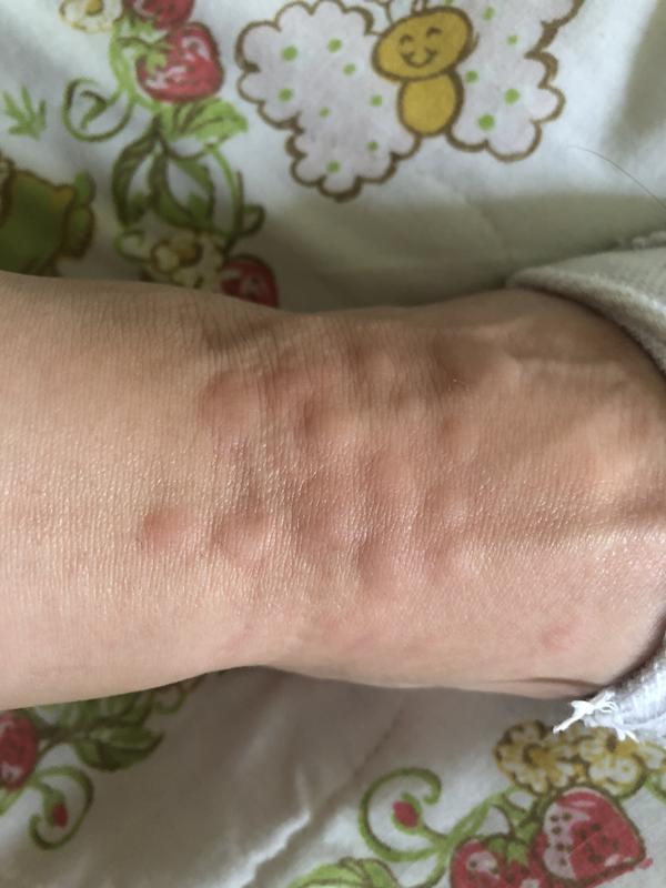 After using this product, this is how many bites I had on the front on my ankle. I was outside for approximately 2 hours.