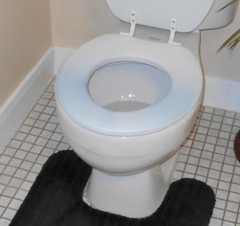 Disappointing to see the black appearing stronger every day now.