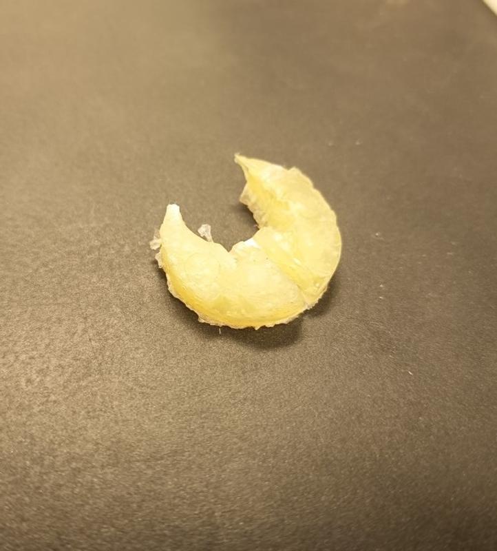 Epoxy plug came out of the part