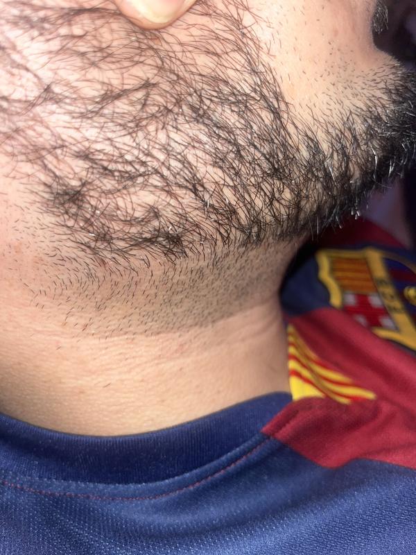 Barbe fraîchement coupé