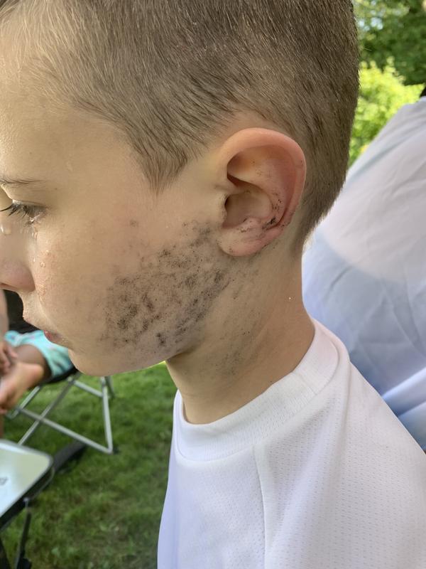 Dye from fluid life jacket