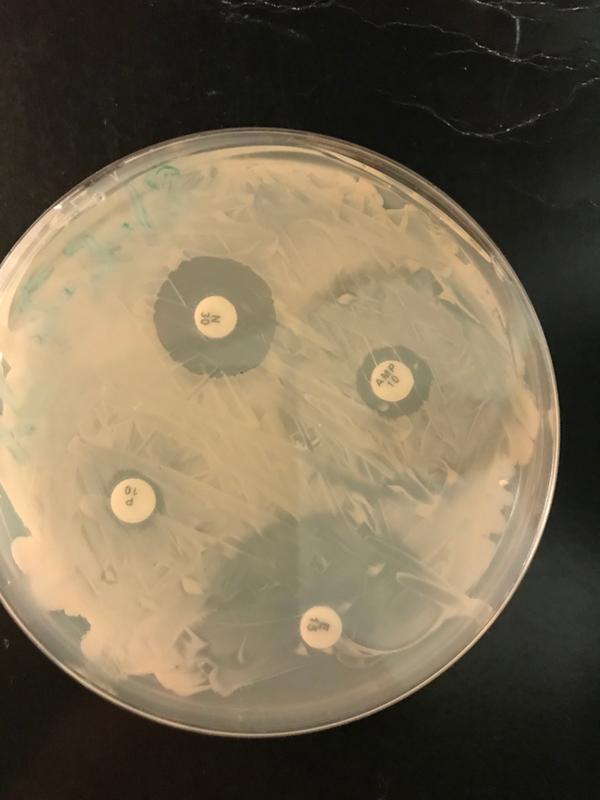 Escherichia coli K 12 Strain Living Broth Tube Carolina