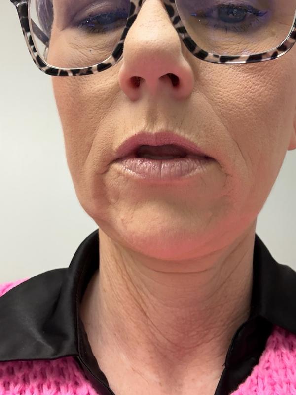 Review Thumbnail Image 4 1215676098