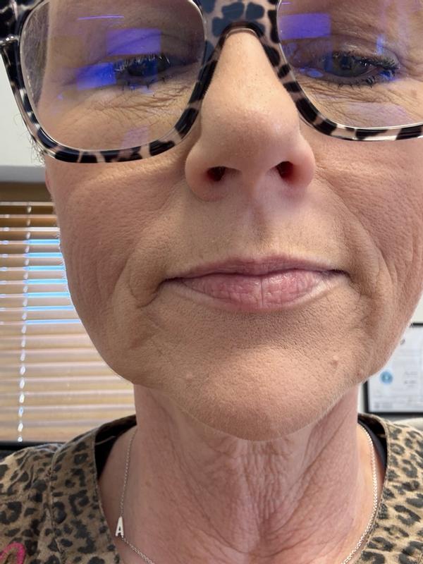 Review Thumbnail Image 2 1215676098