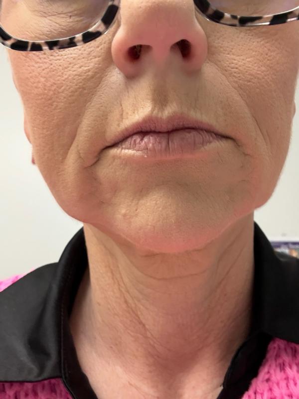 Review Thumbnail Image 3 1215676098