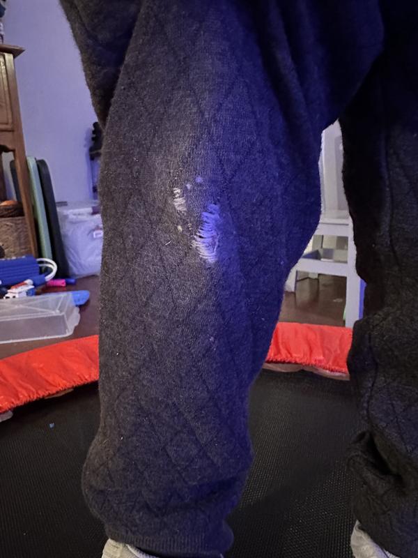 Holes in Right knee