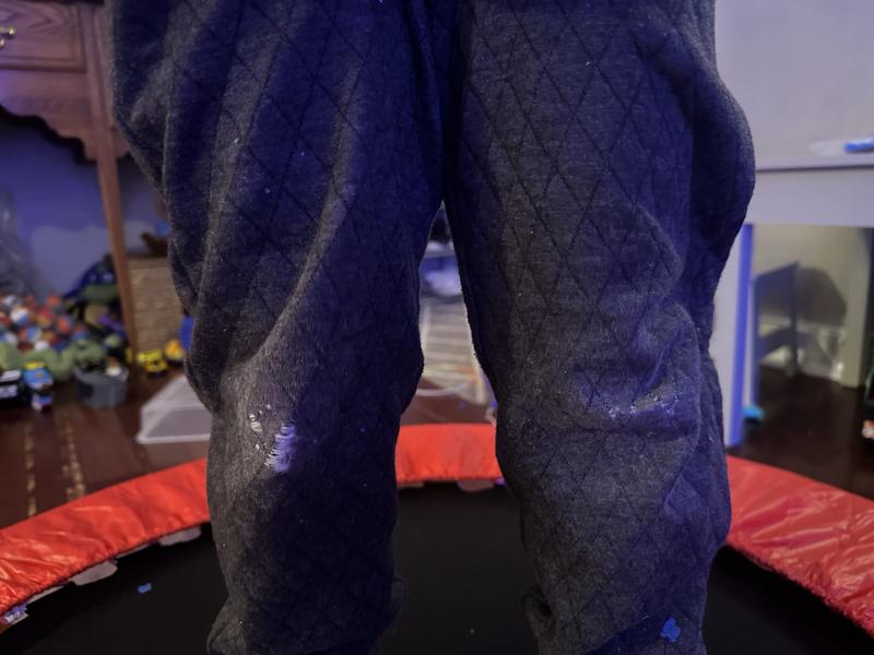 Shows both knees