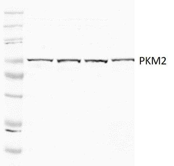 B Actin 13e5 Rabbit Mab Cell Signaling Technology