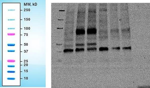 Phospho Ikka B Ser176 180 16a6 Rabbit Mab Cell Signaling Technology