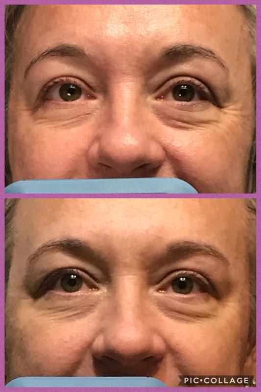 cerave night cream before and after