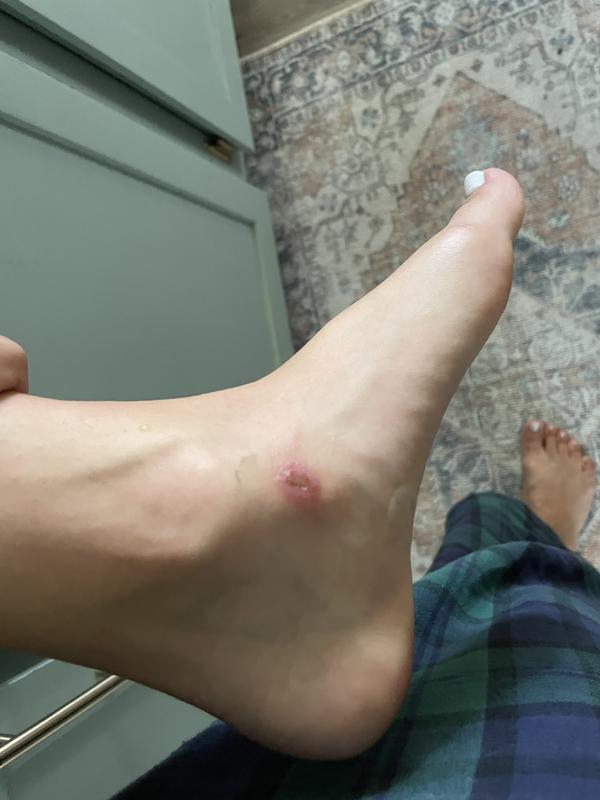 Photo submitted with review of product