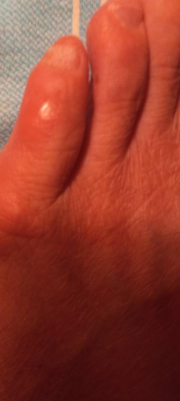Review Thumbnail Image 1 384856061
