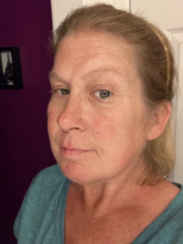 Customer photo for "Nice light serum"