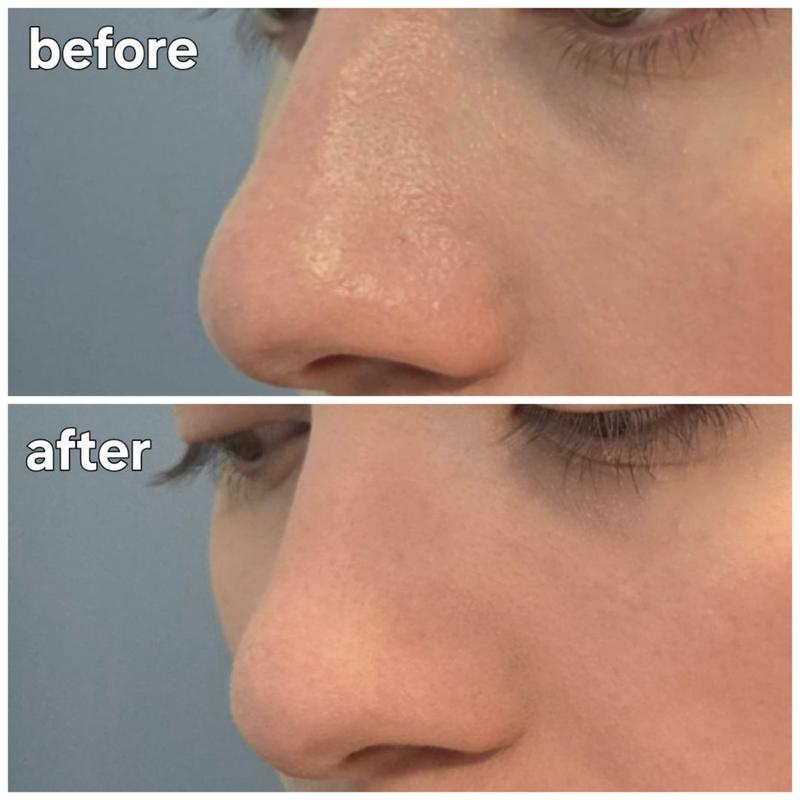 Customer photo for "Great Pressed Powder"