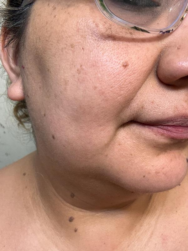 Customer photo for "Smooths and controls shine without making my skin look cakey."
