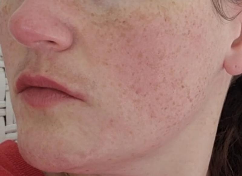 Review Thumbnail Image 0 1143589743