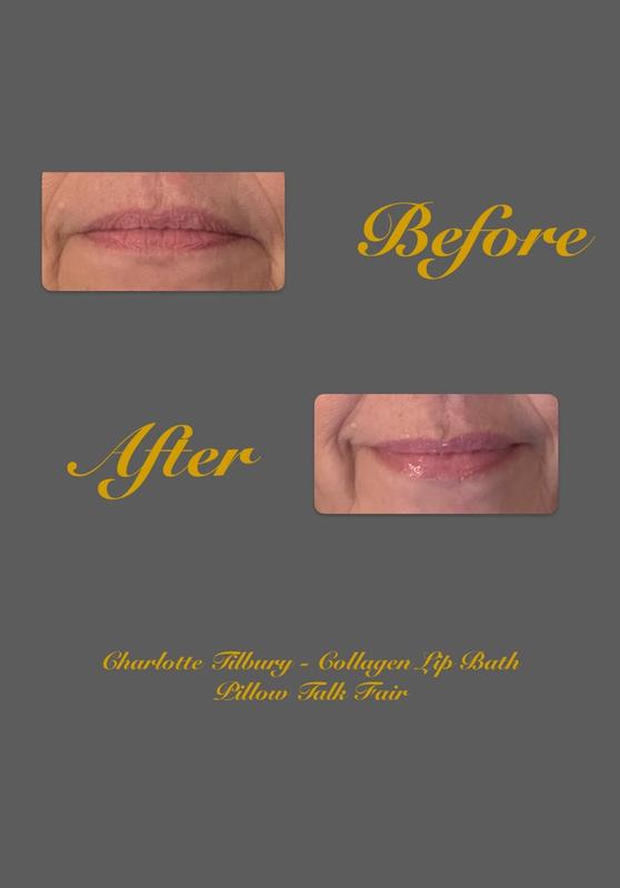 Customer photo for "Fuller lips"