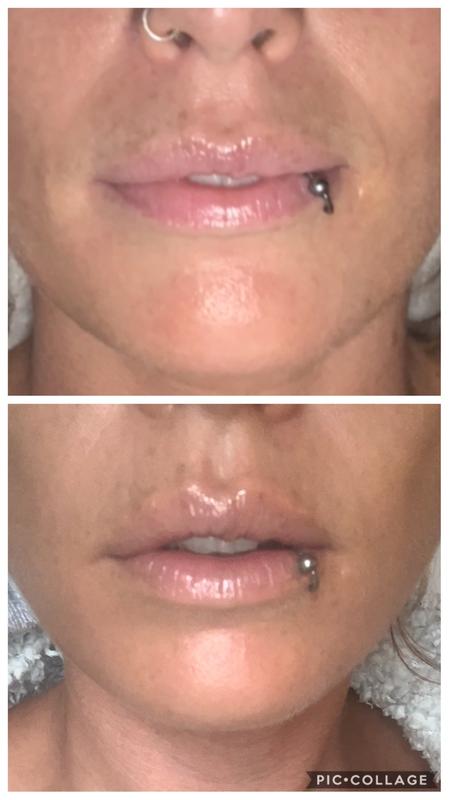 Extraordinary Lip Oil with a week of use