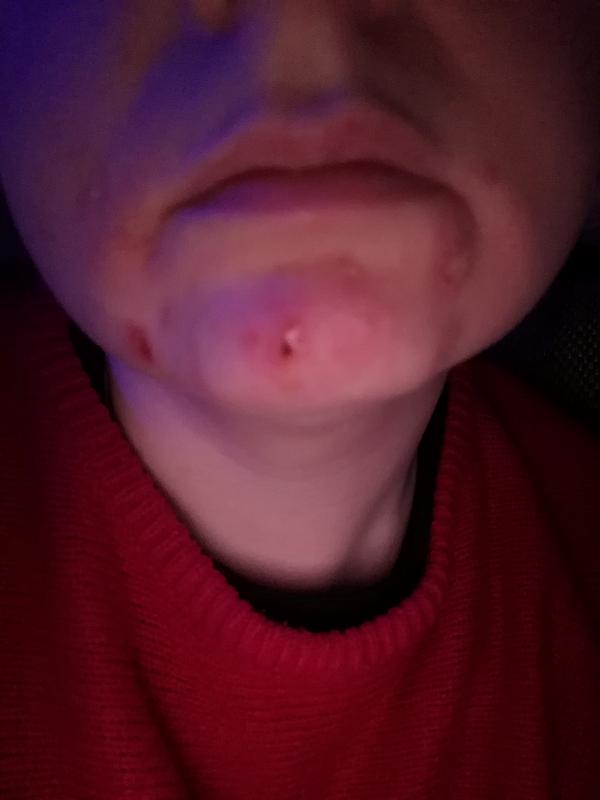 Dissapointed with after treatment results