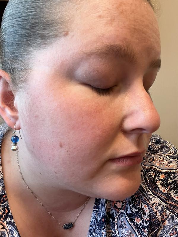 Product dried out my skin and burned my face