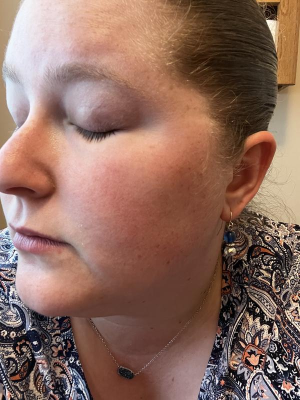 Product dried out my skin and burned my face