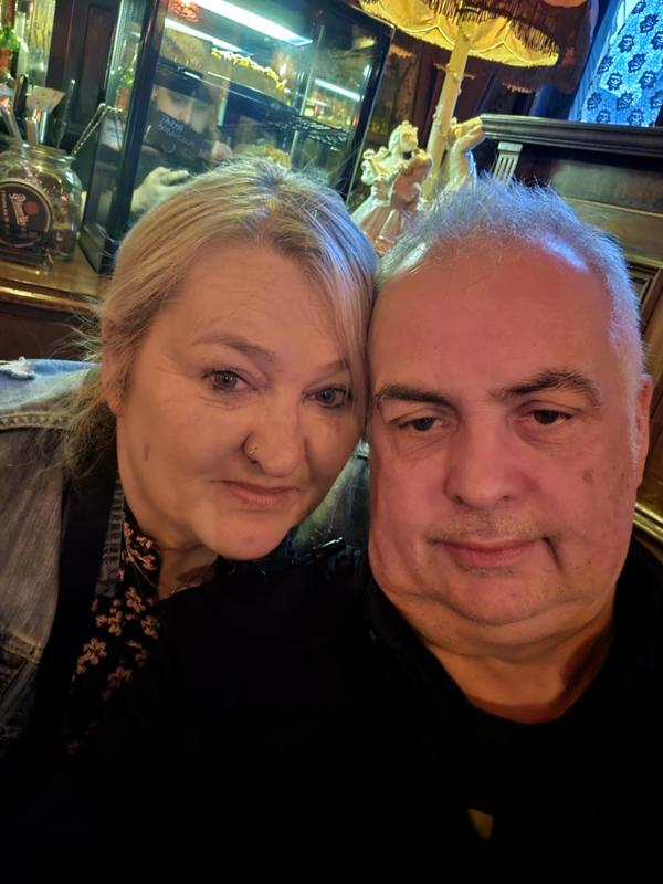 Eyes look more puffy