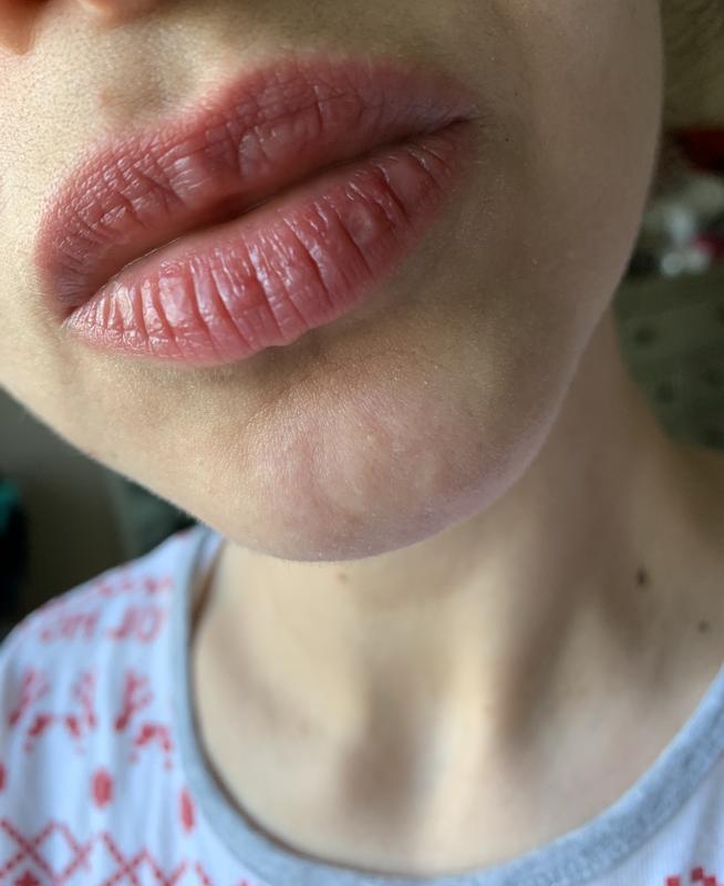 Customer photo for "Disappointed"